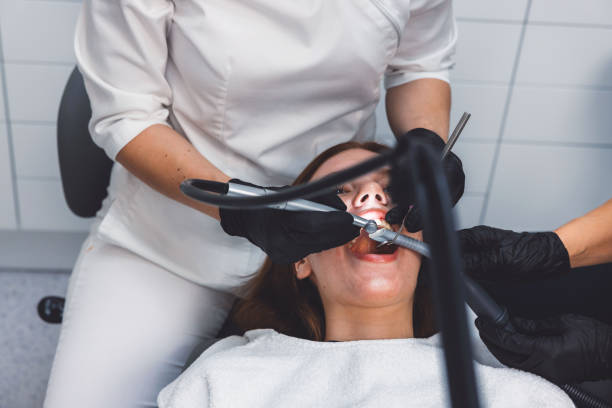Best Knocked-Out Tooth (Avulsed Tooth) Treatment in Jordan, NY
